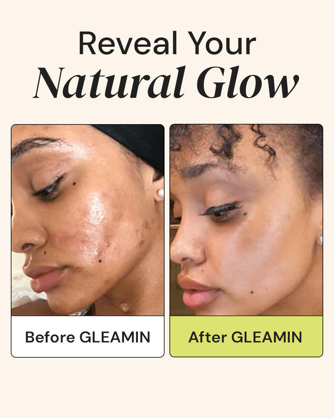 Advanced Brightening Moisturizer