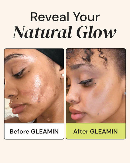 Advanced Brightening Moisturizer