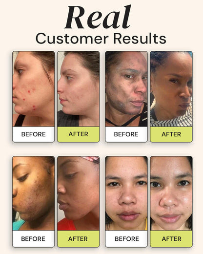 Advanced Brightening Moisturizer